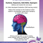 Business 1 image CORE BRAIN DEVELOPMENT Educational Aids in Port Elizabeth EC