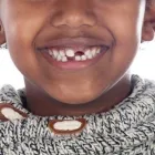 Maatskappy 5 beeld DR ANDRÉ DE VILLIERS Orthodontics in Cape Town WC