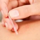 Business 4 image DR JACQUES H MAREE CHIROPRACTOR Whiplash in Pretoria GP