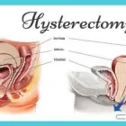 Maatskappy 2 beeld FIBROID TREATMENT CLINIC AFRICA Uterine Fibroids in Cape Town WC