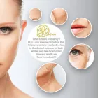Maatskappy 1 beeld GLO LASER AND BEAUTY Stretch Marks in Pretoria GP