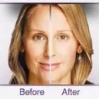 Maatskappy 2 beeld SUNROOM BRYANPARK Teeth Whitening in Johannesburg GP