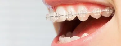 Maatskappy 2 beeld DR ANDRÉ DE VILLIERS Orthodontics in Cape Town WC